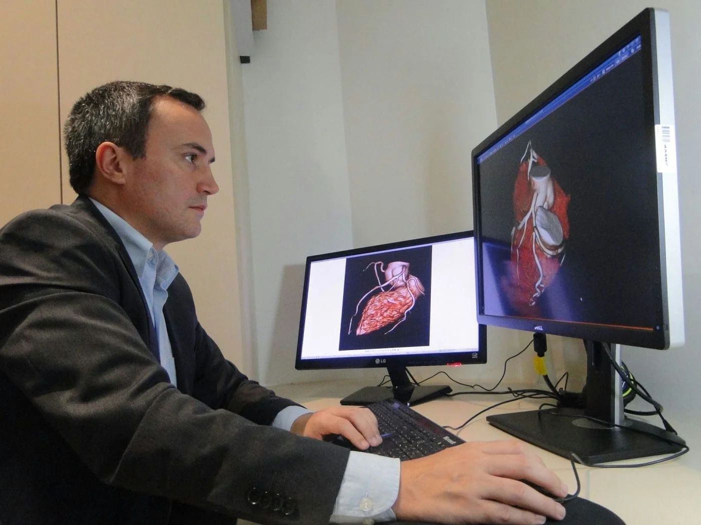 Angiotomografia computadorizada permite diagnóstico precoce