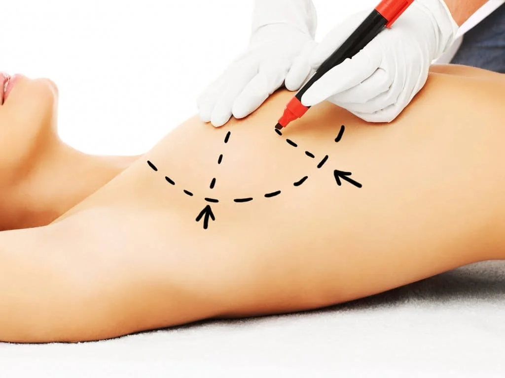 Reconstrução mamária pós-cirurgia de câncer de mama