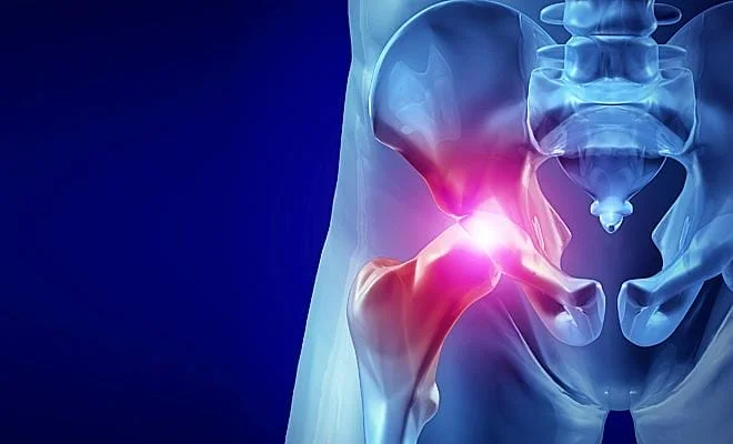 Uma esperança de alívio de dor em quem sofre muito com artrose